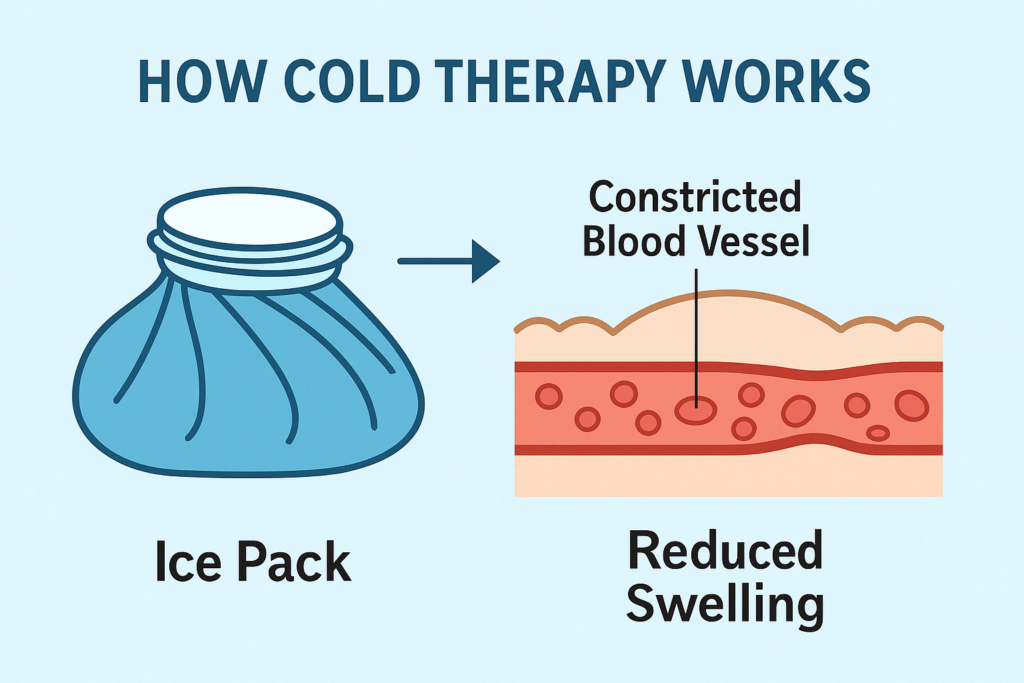 Heat vs Cold Therapy: How Cold Therapy Works