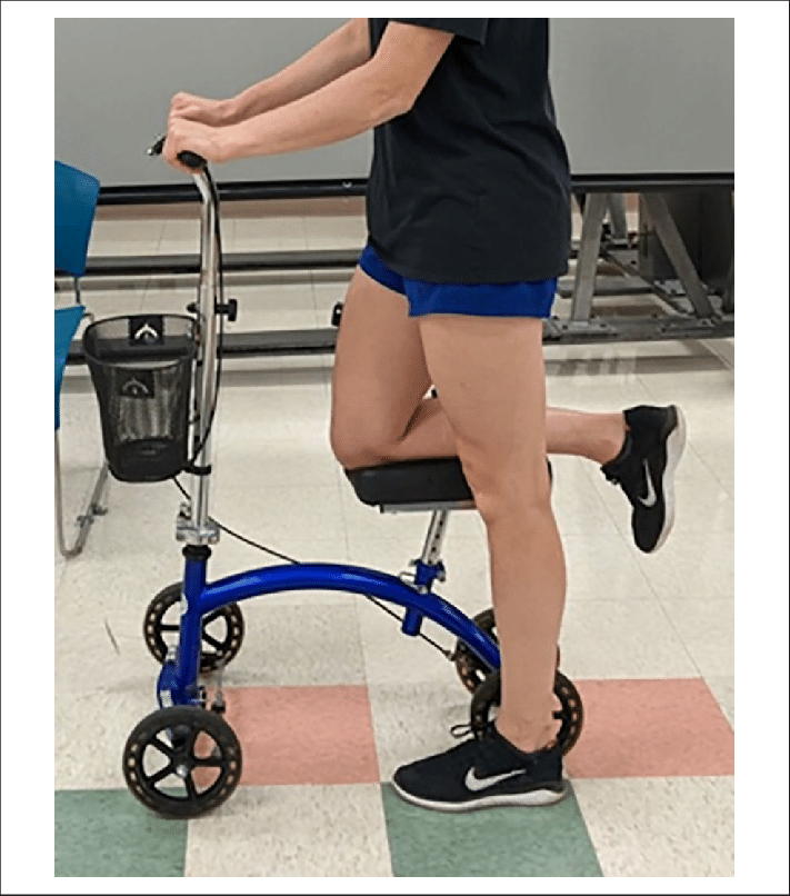 Assistive Devices for Walking: Knee Scooters