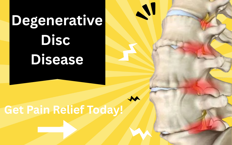 Read more about the article Degenerative Disc Disease: Causes, Symptoms, and Best Treatment Options 2025