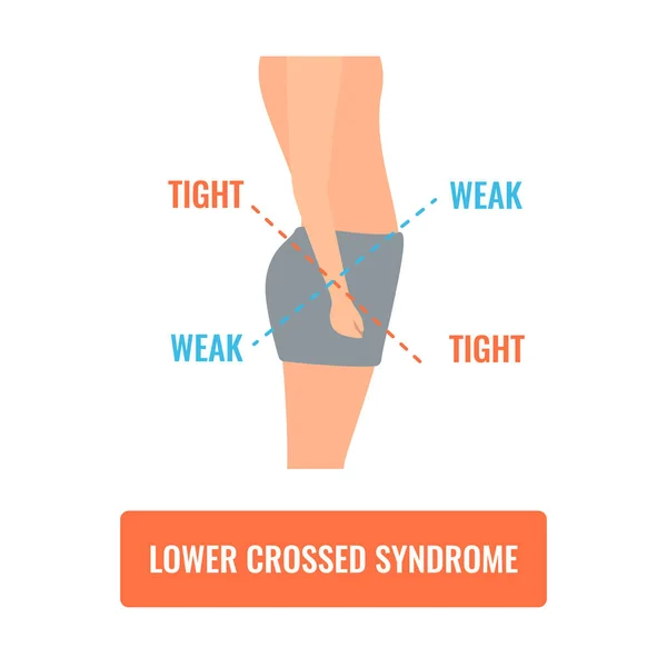 How Poor Posture Leads to Back & Neck Pain: Muscle Imbalances and Weakness