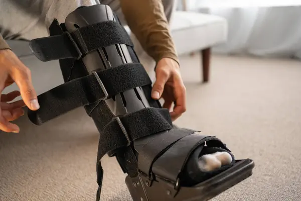 Achilles Rupture Recovery Without Surgery: Walking Boot (CAM Boot)
