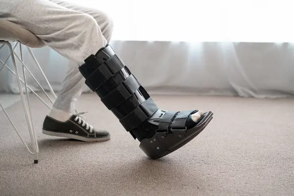 Achilles Rupture Recovery Without Surgery: Weeks 0-2: Protection and Rest
